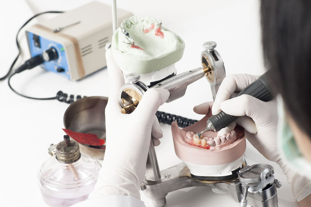 各分野の専門歯科技工士